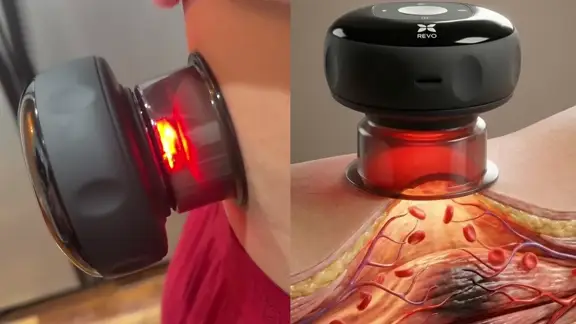 Revo Cupping Massager